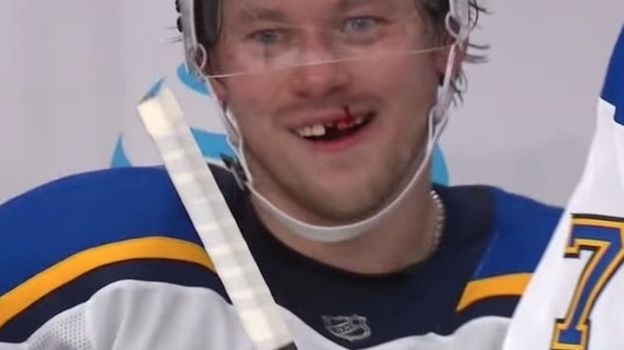 Виннипег – Вашингтон – 3:1, чемпионат НХЛ, 15 октября 2018 года, обзор матчей, видео голов, Кузнецов получил травму, Тарасенко выбили зуб