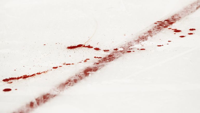 Убийства, драки, стрельба. Сколько еще безумия будет в детском хоккее?