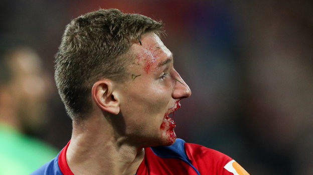 КДК РФС дисквалифицировал защитника «Сочи», который сломал нос Чалову, что Магомед Дудов сказал судье после матча со «Спартаком»
