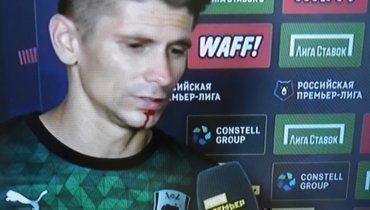 Мартынович дал интервью в перерыве матча «Краснодар» — «Крылья» с окровавленным подбородком