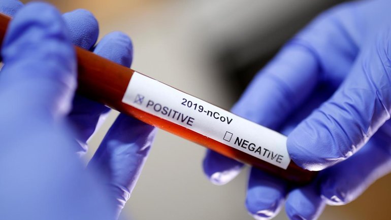 США вышли на первое место по количеству умерших от коронавируса