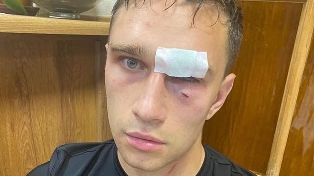за что широков ударил судью. Смотреть фото за что широков ударил судью. Смотреть картинку за что широков ударил судью. Картинка про за что широков ударил судью. Фото за что широков ударил судью