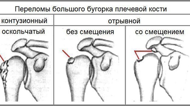 Стало известно, почему был заменен арбитр матча "Ахмат" - "Уфа". Спорт-Экспресс