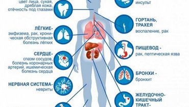 В чем заключается вред курения для здоровья человека. don. В чем заключается вред курения для здоровья человека фото. В чем заключается вред курения для здоровья человека-don. картинка В чем заключается вред курения для здоровья человека. картинка don