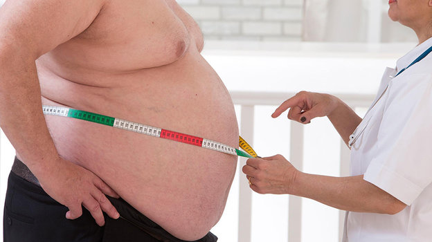 Ожирение: причины, симптомы, диагностика и лечение – статьи о здоровье