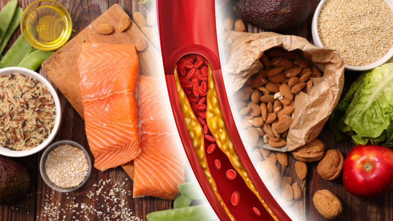 Как снизить холестерин без статинов — 7 продуктов, полезных для сердца и сосудов