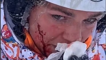 Юлия Ефимова в кровь разбила лицо во время катания на сноуборде