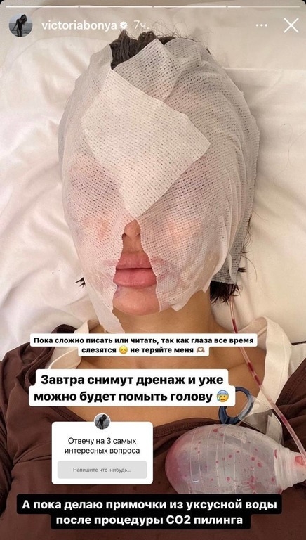 Виктория Боня раскрыла правду о последствиях пластической операции за 20 млн рублей